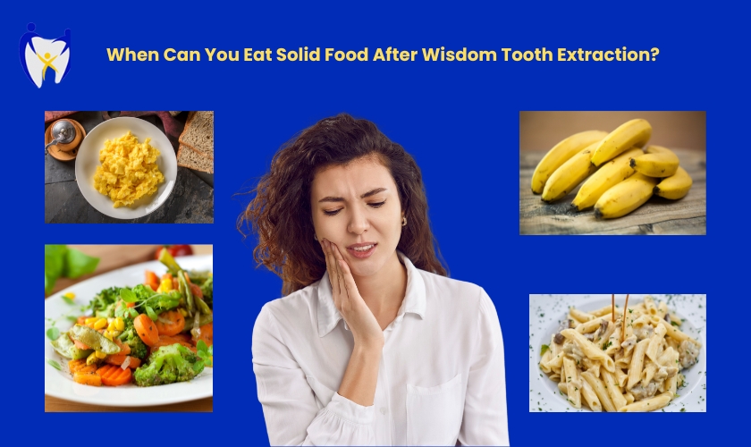 When Can You Eat Solid Food After Tooth Extraction: Quick Guide